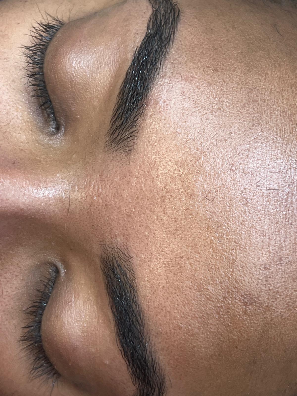 Brow threading