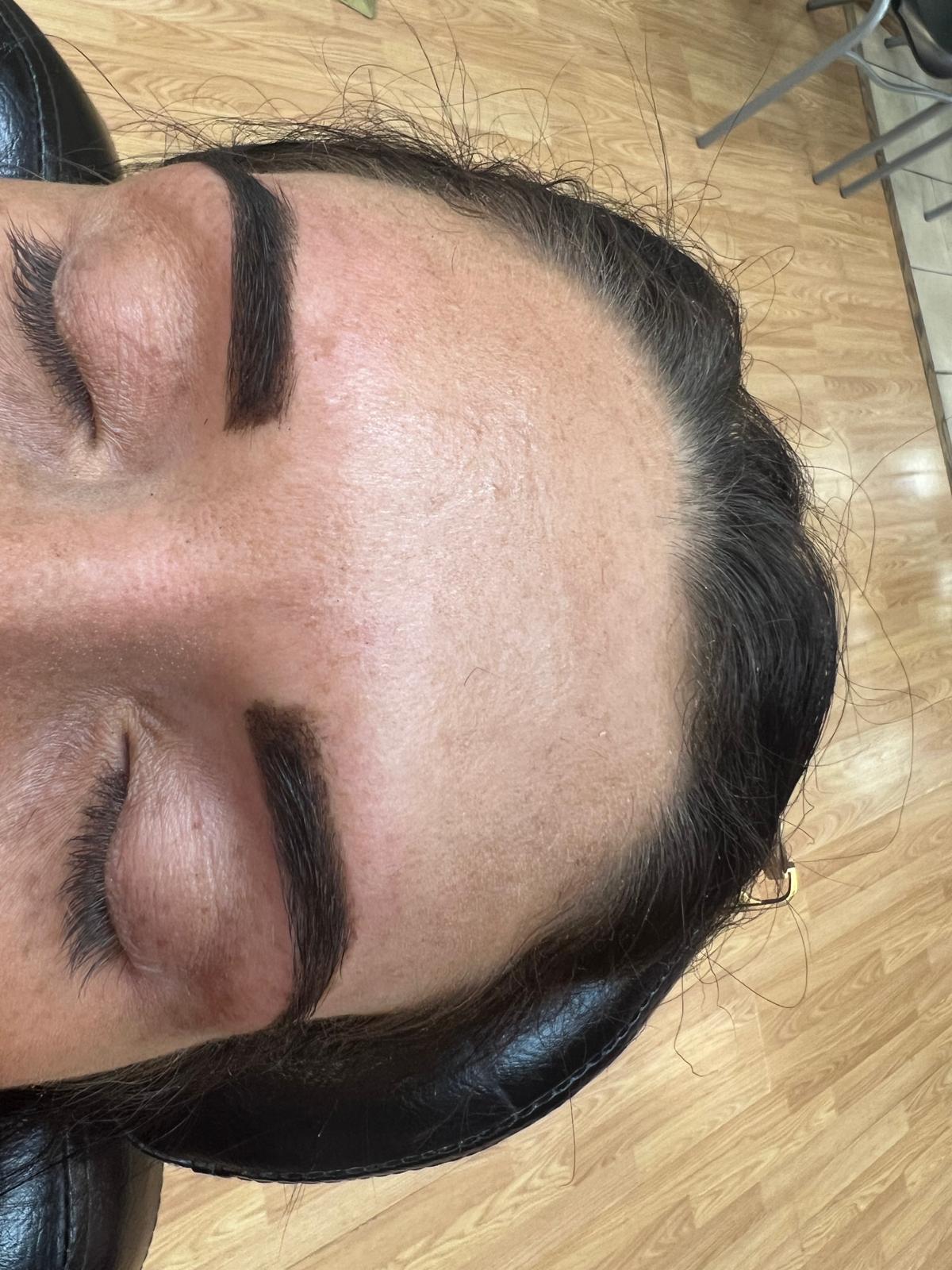 Brow threading